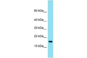 Host: Rabbit Target Name: TMEM190 Sample Type: Fetal Heart lysates Antibody Dilution: 1. (TMEM190 Antikörper  (C-Term))