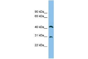 WB Suggested Anti-ADA Antibody Titration: 0. (ADA Antikörper  (N-Term))