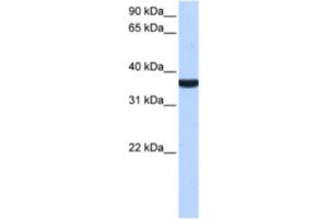 Western Blotting (WB) image for anti-Tumor Protein P53 Inducible Protein 13 (TP53I13) antibody (ABIN2463454)
