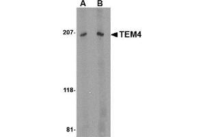 Western blot analysis of TEM4 in Jurkat Cell lysate with this product at (A) 1 and (B) 2 μg/ml. (ARHGEF17 Antikörper  (Center))