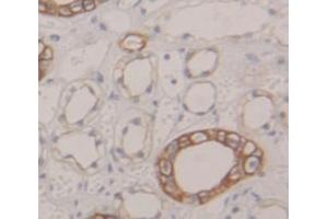 IHC-P analysis of Human Tissue, with DAB staining. (AP2M1 Antikörper  (AA 170-435))