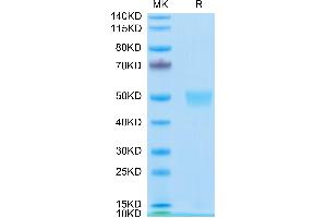 Human LRG1 on Tris-Bis PAGE under reduced condition. (LRG1 Protein (AA 36-347) (His tag))