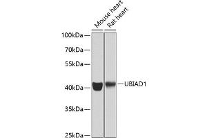 Western blot analysis of extracts of various cell lines, using UBI antibody (ABIN6134946, ABIN6149845, ABIN6149848 and ABIN6223555) at 1:1000 dilution. (UBIAD1 Antikörper  (AA 1-100))