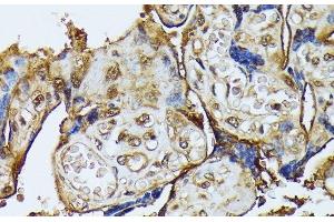 Immunohistochemistry of paraffin-embedded Human placenta using DAPK3 Polyclonal Antibody at dilution of 1:100 (40x lens). (DAPK3 Antikörper)