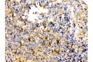 TRIB2 was detected in paraffin-embedded sections of rat spleen tissues using rabbit anti- TRIB2 Antigen Affinity purified polyclonal antibody at 1 μg/mL. (TRIB2 Antikörper  (Middle Region))