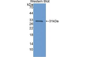 Detection of Recombinant CALB, Rat using Polyclonal Antibody to Calbindin (CALB) (CALB1 Antikörper  (AA 2-261))