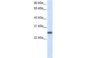 PRDX1 antibody used at 1 ug/ml to detect target protein. (Peroxiredoxin 1 Antikörper  (N-Term))