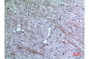 Immunohistochemistry (IHC) analysis of paraffin-embedded Rat Brain, antibody was diluted at 1:100. (CCL26 Antikörper  (Internal Region))