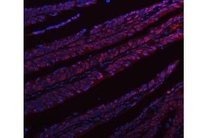 IF analysis of hnRNP L/HNRNPL using anti-hnRNP L/HNRNPL antibody (ABIN7600130). (HNRNPL Antikörper  (AA 152-569))