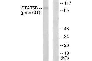 Western blot analysis of extracts from RAW264. (STAT5B Antikörper  (pSer731))