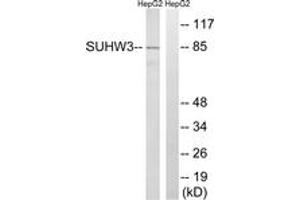 Western blot analysis of extracts from HepG2 cells, using ZNF280C Antibody. (ZNF280C Antikörper  (AA 251-300))