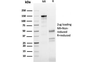 SDS-PAGE Analysis Purified Tubulin beta 3 Mouse Monoclonal Antibody (TUBB3/3731). (TUBB3 Antikörper  (AA 437-450))