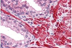 Human Prostate: Formalin-Fixed, Paraffin-Embedded (FFPE) (DPP8 Antikörper  (AA 1-39))