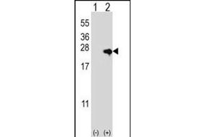 Western blot analysis of NME4 (arrow) using rabbit polyclonal NME4 Antibody (M1) (ABIN392784 and ABIN2842222).