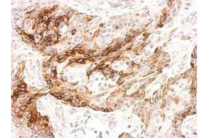 IHC-P Image Galanin Receptor 2 antibody detects GALR2 protein at membrane on Cal27 xenograft by immunohistochemical analysis. (GALR2 Antikörper  (C-Term))