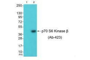 Western blot analysis of extracts from 3T3 cells (Lane 2), using p70 S6 Kinase β (Ab-423) antiobdy. (RPS6KB2 Antikörper  (Ser423))