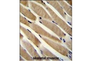 TRIM7 Antibody (N-term) (ABIN655918 and ABIN2845317) immunohistochemistry analysis in formalin fixed and paraffin embedded human skeletal muscle followed by peroxidase conjugation of the secondary antibody and DAB staining. (TRIM7 Antikörper  (N-Term))