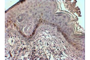 AP31562PU-N (2 µg/ml) staining of paraffin embedded Human Skin. (CMA1 Antikörper  (Internal Region))