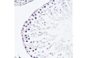 Immunohistochemistry of paraffin-embedded rat testis using FGF12 antibody (ABIN3016419, ABIN3016420, ABIN1679841 and ABIN6219744) at dilution of 1:150 (40x lens). (FGF12 Antikörper  (AA 1-181))