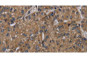 Immunohistochemistry (Paraffin-embedded Sections) (IHC (p)) image for anti-NADH Dehydrogenase (Ubiquinone) Fe-S Protein 6, 13kDa (NADH-Coenzyme Q Reductase) (NDUFS6) antibody (ABIN7241744)