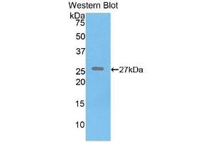 Detection of Recombinant ELN, Human using Polyclonal Antibody to Elastin (ELN) (Elastin Antikörper  (AA 392-645))