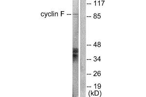 Western Blotting (WB) image for anti-Cyclin F (CCNF) (C-Term) antibody (ABIN1848498) (Cyclin F Antikörper  (C-Term))