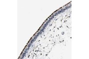 Immunohistochemical staining of human nasopharynx with MTIF2 polyclonal antibody  shows strong membranous positivity in respiratory epithelial cells at 1:20-1:50 dilution. (MTIF2 Antikörper)