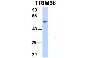 Host:  Rabbit  Target Name:  TRIM68  Sample Type:  Human Fetal Heart  Antibody Dilution:  1. (TRIM68 Antikörper  (Middle Region))