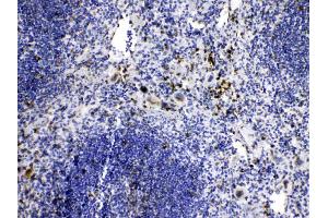 IHC analysis of Caspase8 using anti-Caspase8 antibody . (Caspase 8 Antikörper  (N-Term))