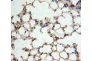 Used in DAB staining on fromalin fixed paraffin-embedded Lung tissue (IL22RA2 Antikörper  (AA 31-223))