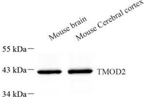 Western blot analysis of TMOD2 (ABIN7076027) at dilution of 1: 500 (TMOD2 Antikörper)