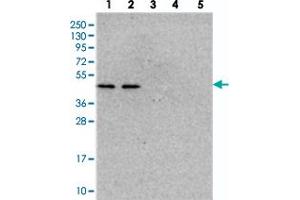 Western blot analysis of Lane 1: RT-4, Lane 2: U-251 MG, Lane 3: Human Plasma, Lane 4: Liver, Lane 5: Tonsil with NSUN6 polyclonal antibody  at 1:250-1:500 dilution. (NSUN6 Antikörper)