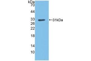 Detection of Recombinant LDLR, Human using Polyclonal Antibody to Low Density Lipoprotein Receptor (LDLR) (LDLR Antikörper  (AA 497-742))