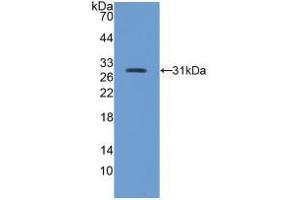 Western blot analysis of recombinant Mouse ITGb5. (Integrin beta 5 Antikörper  (AA 136-378))