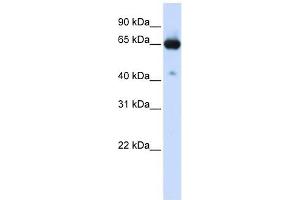 SLC39A4 antibody used at 1 ug/ml to detect target protein. (SLC39A4 Antikörper)