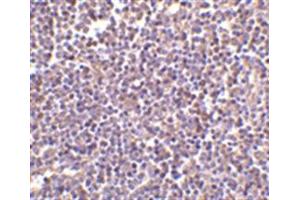 Image no. 2 for anti-CD5 Molecule-Like (CD5L) (N-Term) antibody (ABIN318737) (CD5L Antikörper  (N-Term))