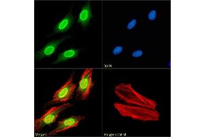 Immunofluorescence staining of fixed HeLa cells with anti-H3K27me3 antibody BT164. (Rekombinanter Histone 3 Antikörper  (H3K27me3))