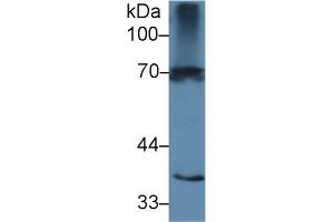 Western Blotting (WB) image for anti-Interleukin 1 Receptor, Type I (IL1R1) (AA 386-553) antibody (ABIN7437959)