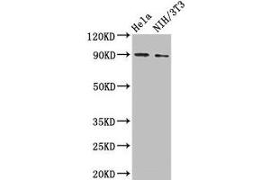 Western Blot Positive WB detected in: Hela whole cell lysate, NIH/3T3 whole cell lysate All lanes: L1CAM antibody at 2 μg/mL Secondary Goat polyclonal to rabbit IgG at 1/50000 dilution Predicted band size: 141, 140, 139 kDa Observed band size: 90 kDa (L1CAM Antikörper  (AA 995-1119))