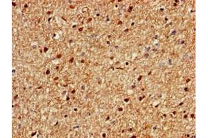 Immunohistochemistry of paraffin-embedded human brain tissue using ABIN7166170 at dilution of 1:100 (Chromosome 1 Open Reading Frame 84 (C1orf84) (AA 2396-2517) Antikörper)