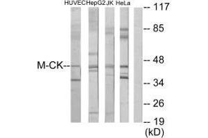 Western blot analysis of extracts from HUVEC cells, HepG2 cells, Jurkat cells and HeLa cells, using M-CK antibody.