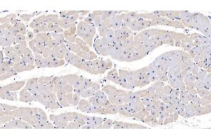 Detection of PTP4A3 in Human Cardiac Muscle Tissue using Polyclonal Antibody to Protein Tyrosine Phosphatase Type IVA 3 (PTP4A3) (PTP4A3 Antikörper  (AA 1-170))