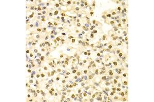 Immunohistochemistry (Paraffin-embedded Sections) (IHC (p)) image for anti-Hepatoma-Derived Growth Factor (HDGF) (AA 1-240) antibody (ABIN6141694)