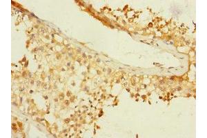 Immunohistochemistry of paraffin-embedded human testis tissue using ABIN7145902 at dilution of 1:100 (BTNL3 Antikörper  (AA 18-237))