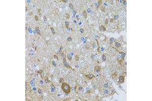 Immunohistochemistry of paraffin-embedded rat brain using DYNC1I1 antibody at dilution of 1:100 (x40 lens). (DYNC1I1 Antikörper)