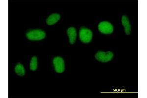 Immunofluorescence of purified MaxPab antibody to NFATC2IP on HeLa cell. (NFATC2IP Antikörper  (AA 1-138))