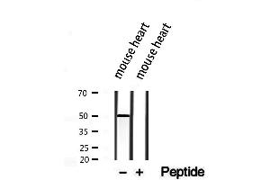 Western blot analysis of extracts from mouse heart, using CRLS1-Specific antibody. (CRLS1 Antikörper  (Internal Region))