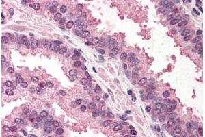 Human Prostate (formalin-fixed, paraffin-embedded) stained with RAD23A antibody ABIN290446 at 5 ug/ml followed by biotinylated anti-goat IgG secondary antibody ABIN481715, alkaline phosphatase-streptavidin and chromogen. (RAD23A Antikörper  (AA 122-135))