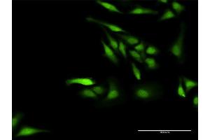 Immunofluorescence of purified MaxPab antibody to NPLOC4 on HeLa cell.