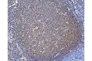 IHC analysis of TOMM40 using anti-TOMM40 antibody (ABIN7599738). (TOMM40 Antikörper  (AA 111-315))